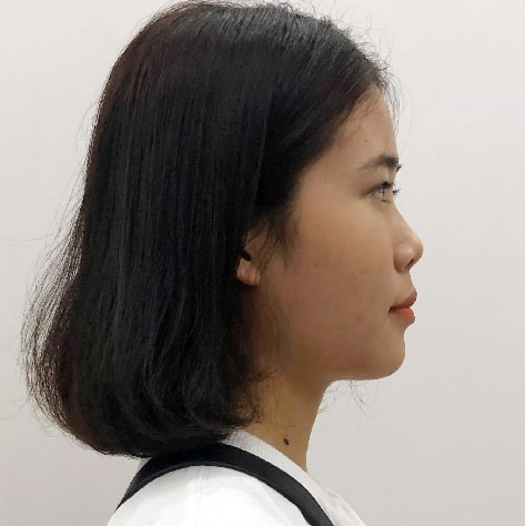 thanh-an nha-khoa-thanh-an